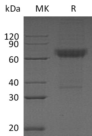 Human CD16b +SDS-PAGE-2.jpg
